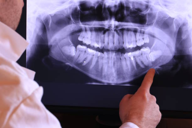 Best Emergency Treatment for Dental Infections or Abscesses in Rexland Acres, CA