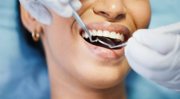 Best Emergency Wisdom Teeth Removal in Rexland Acres, CA