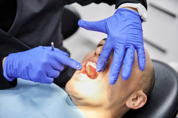Best Pediatric Emergency Dentist in Rexland Acres, CA